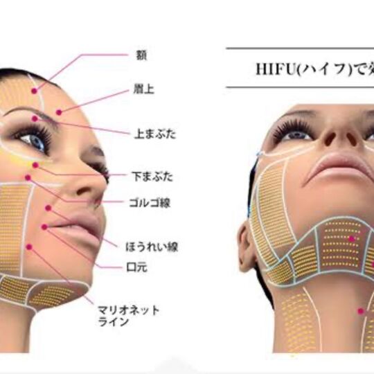 6E3ACF06-661E-4C2B-8988-22BB8B9ACD75