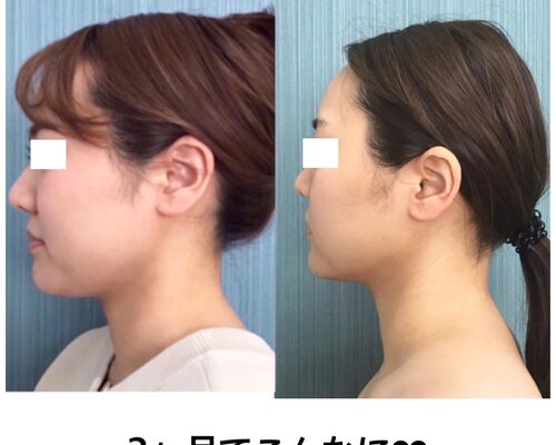C689DB77-BFB9-43BD-847E-B00FC9AC1259
