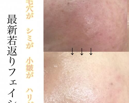 1C9A095E-8066-4B44-892B-FA09426AAE7F