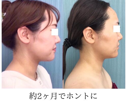 851B7A27-20EC-4493-AC5E-C97A8CE0AD67