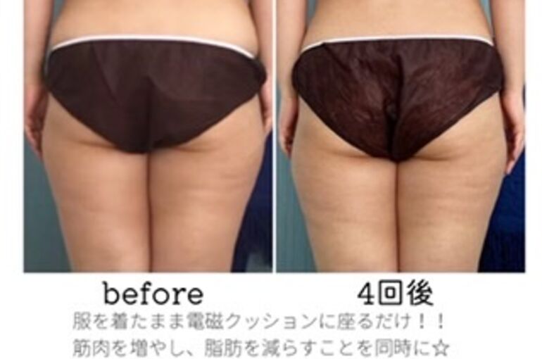 電磁パルス　hi-met 痩身　スカルプト　坐骨クッション　骨盤型 電磁パルス＋坐骨クッション/hi-met 痩身/スカルプト/電磁パルス痩身