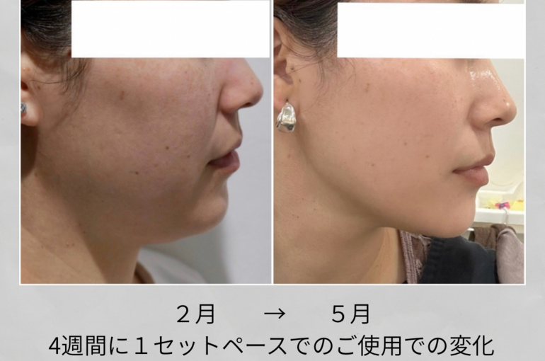 質感のある3枚の画像 ポラロイド Instagramストーリー